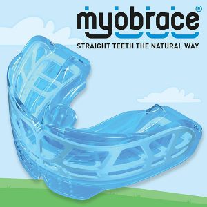What are Myobrace Orthodontic Expanders?