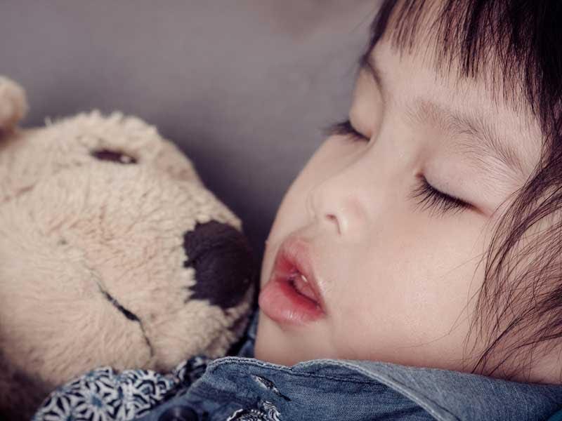 kids sleep apnea dental appliance