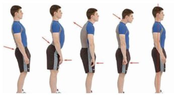 posture restoration with chiropractic