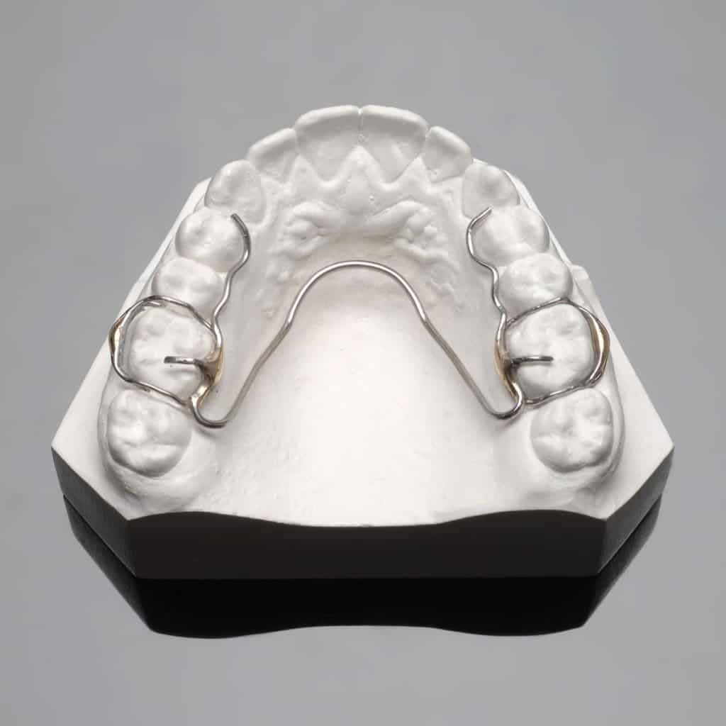 Crozat Adult Palatal Expander-What is it and How it Works