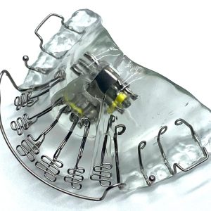 palatal expander for TMJ