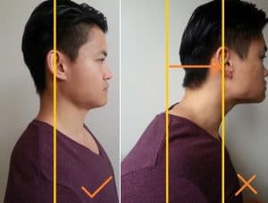 mouth breathing and forward head posture 