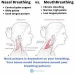 How Mouth Breathing causes Bad Posture