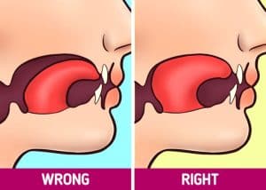 tongue suction palate