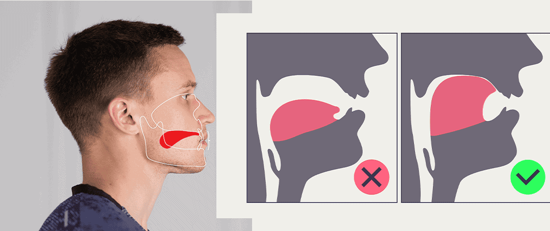 All about Mewing in Face, Jaw Development and Fixing Mouth Breathing