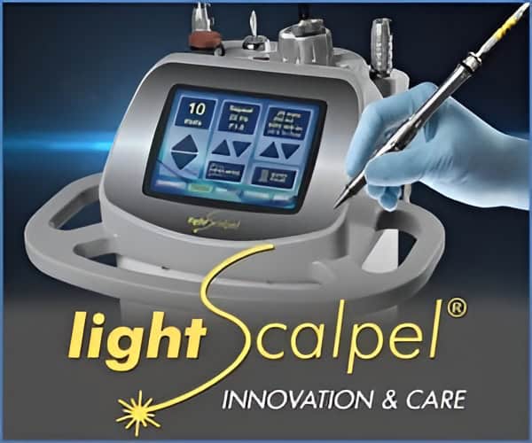 lightscalpel tongue tie release laser procedure
