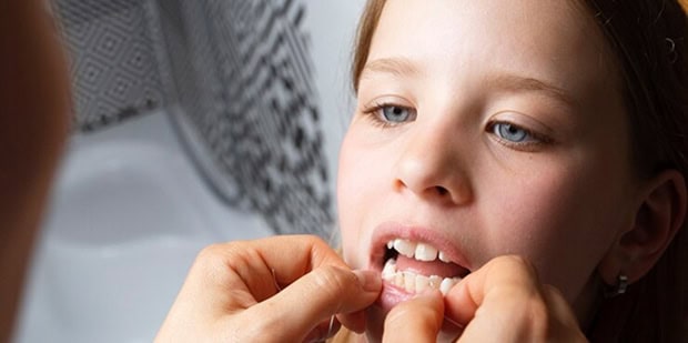 myofunctional therapy exercises for tongue tie release