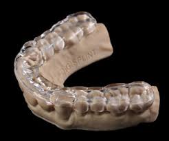 bite splint for tmj