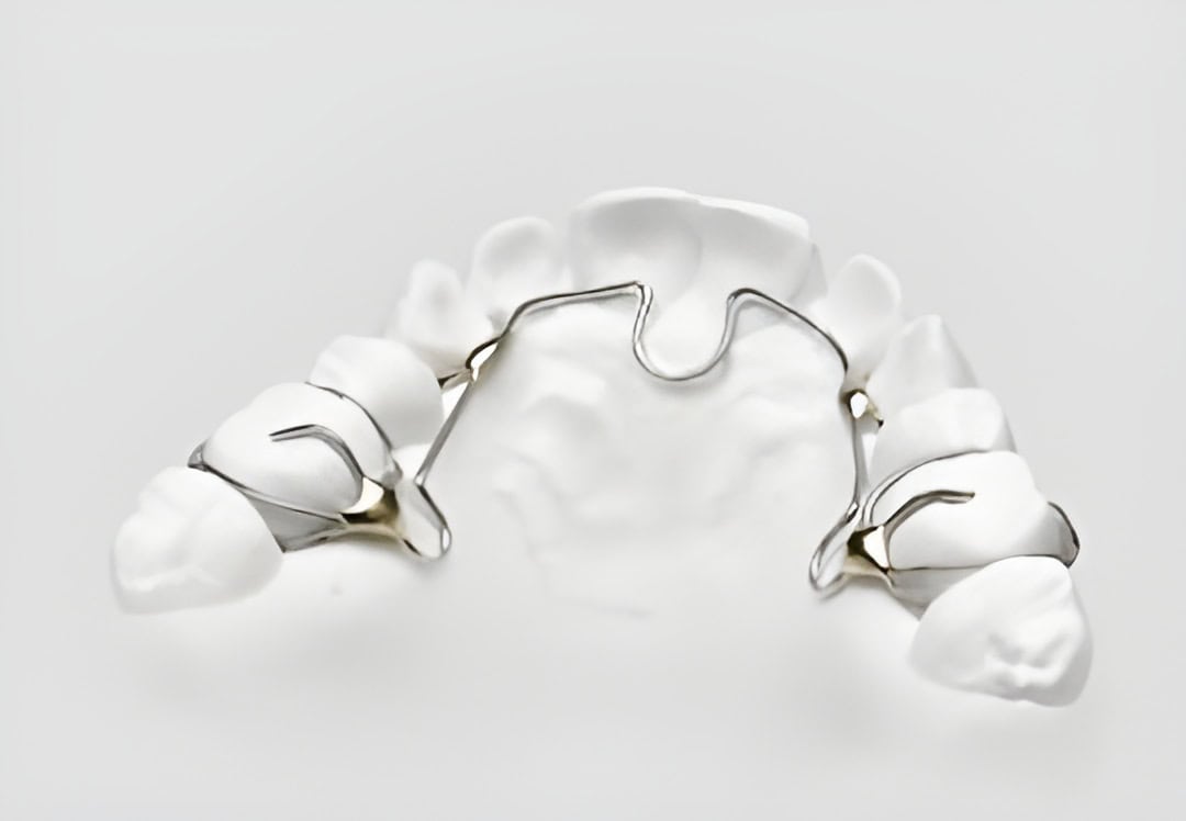 ALF Appliance is a Gentle Alternative to Braces