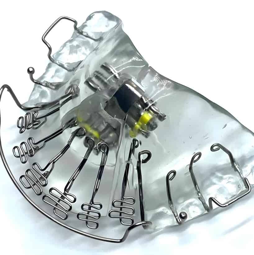 Exploring MARPE Expander-How it Works, Costs and Alternatives
